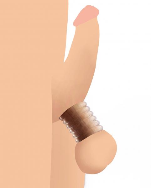 Ring Master Custom Ball Stretcher Kit